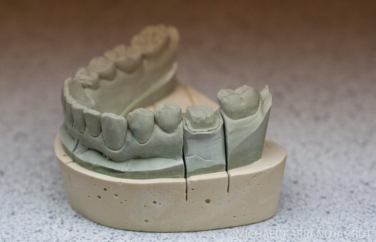 Dental Lab Model Fabrication | Making Noise And Drinking Beer Dental Lab Model Fabrication | Making Noise And Drinking Beer on Granite Models
id=23077