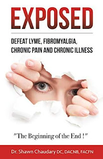 EXPOSED: Defeat Lyme Disease, Fibromyalgia, Chronic Pain, and Chronic Illness: The Beginning of the End! by Dr. Shawn Chaudary