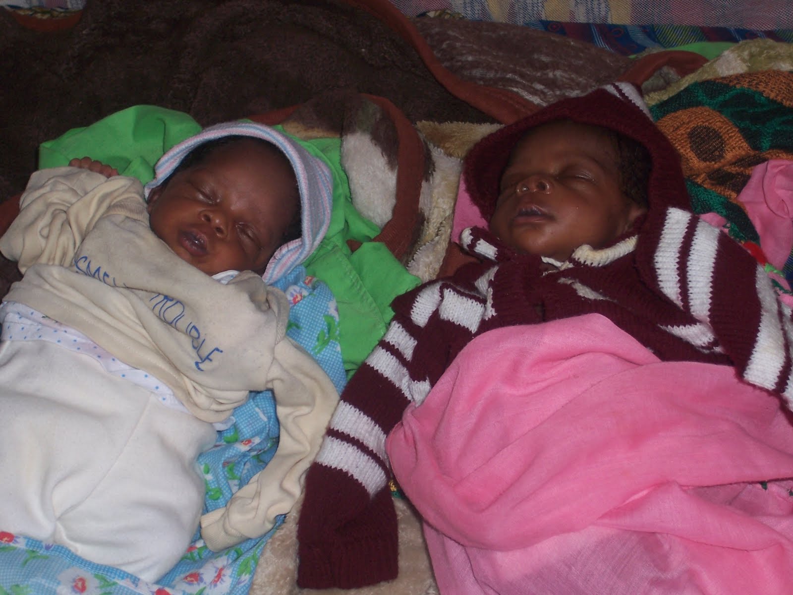lost twins and hysterectomy lost twins and hysterectomy