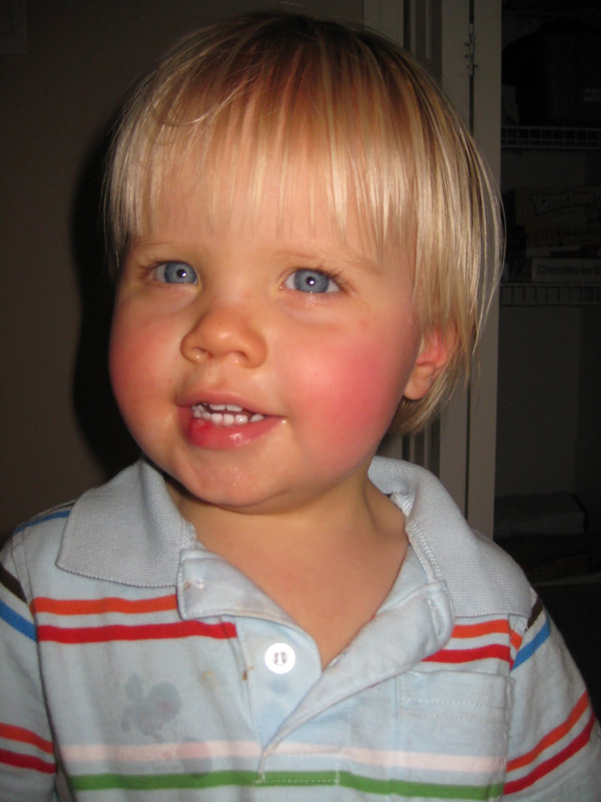 Katz Kidz Busted lip and still smiling!