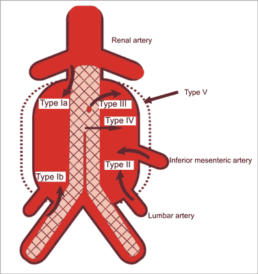 Persistent type. Persistent type. Persist перевод. Постоянное http-соединение. Apache netbeans php.