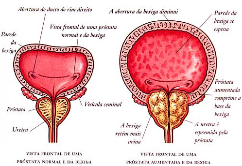 valores de prostata normal