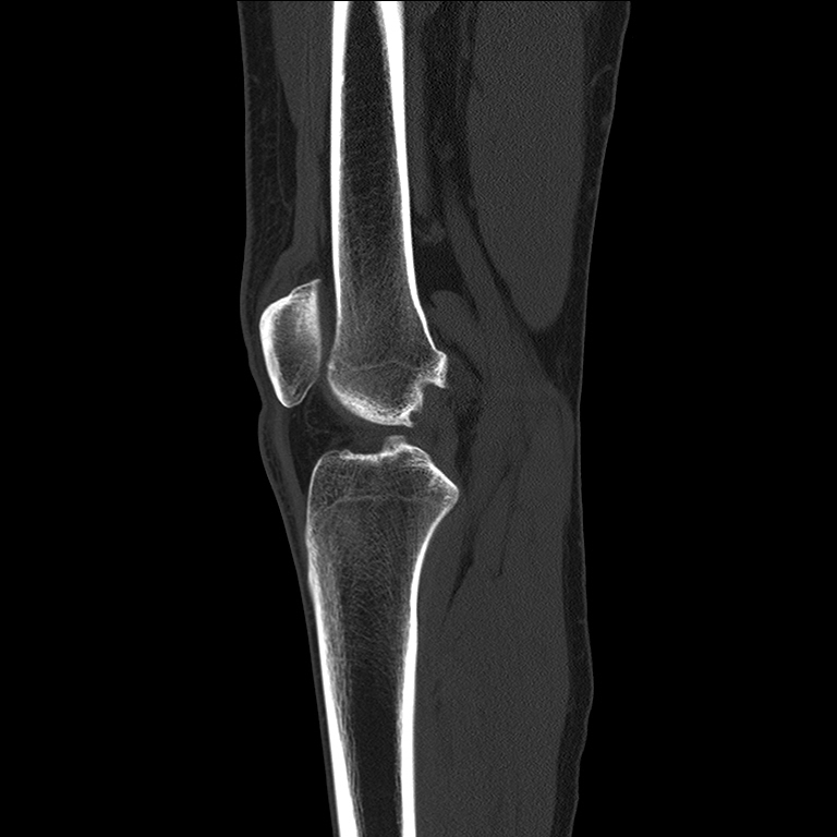 CT Knee Radiology Imaging