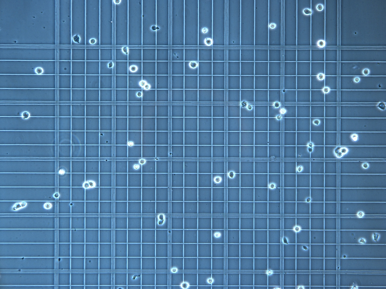 Exámenes de laboratorio y su aporte al diagnóstico Algunos elementos