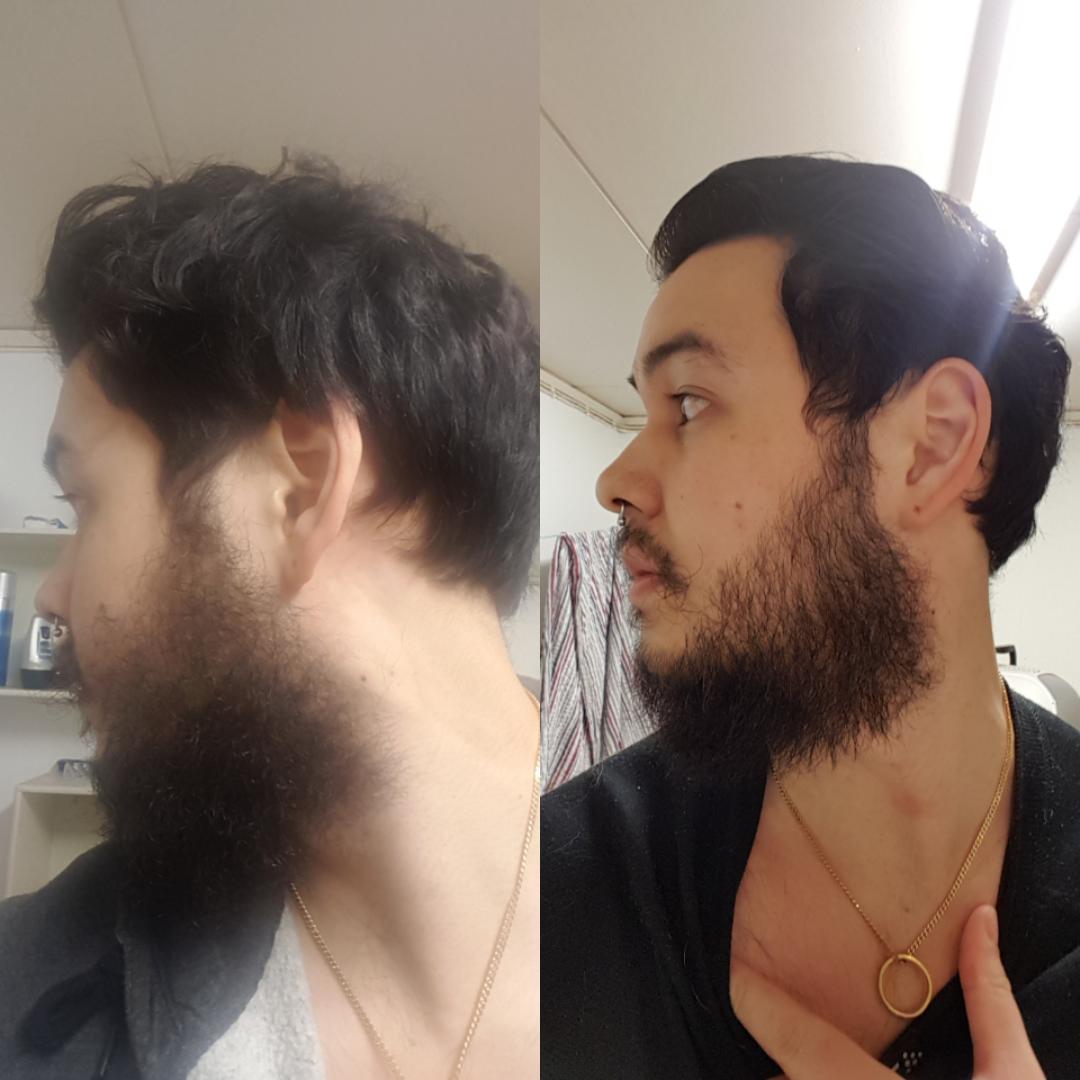 skägg under hakan skägg under hakan