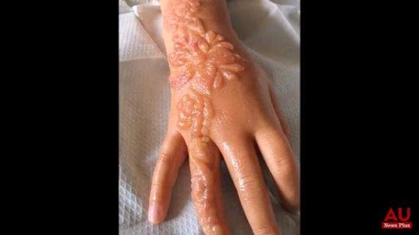 Tatuaje de `marca de por vida´a niña de 7 años de edad. Tatuaje de `marca de por vida´a niña de 7 años de edad.