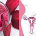 Poderoso batido para combatir miomas y quistes ováricos ¡Sumamente fácil de preparar!