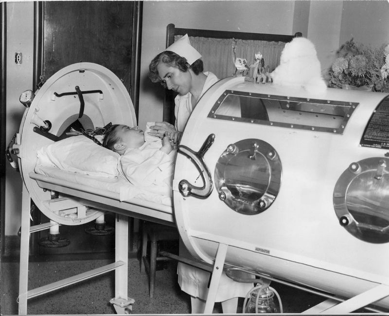 20 Vintage Photos of Iron Lungs for Polio Victims From Between the