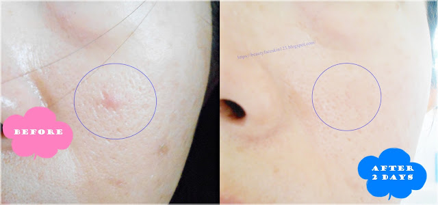 iUNIK Tea Tree Relief Serum iUNIK Tea Tree Relief Serum
