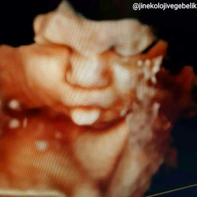 38 haftalık gebelik görüntüsü