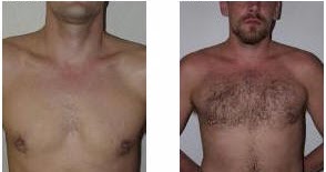 What Other Options Then FUT