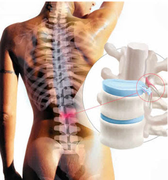 Mejor medicamento para bajar de peso rapido photo 8