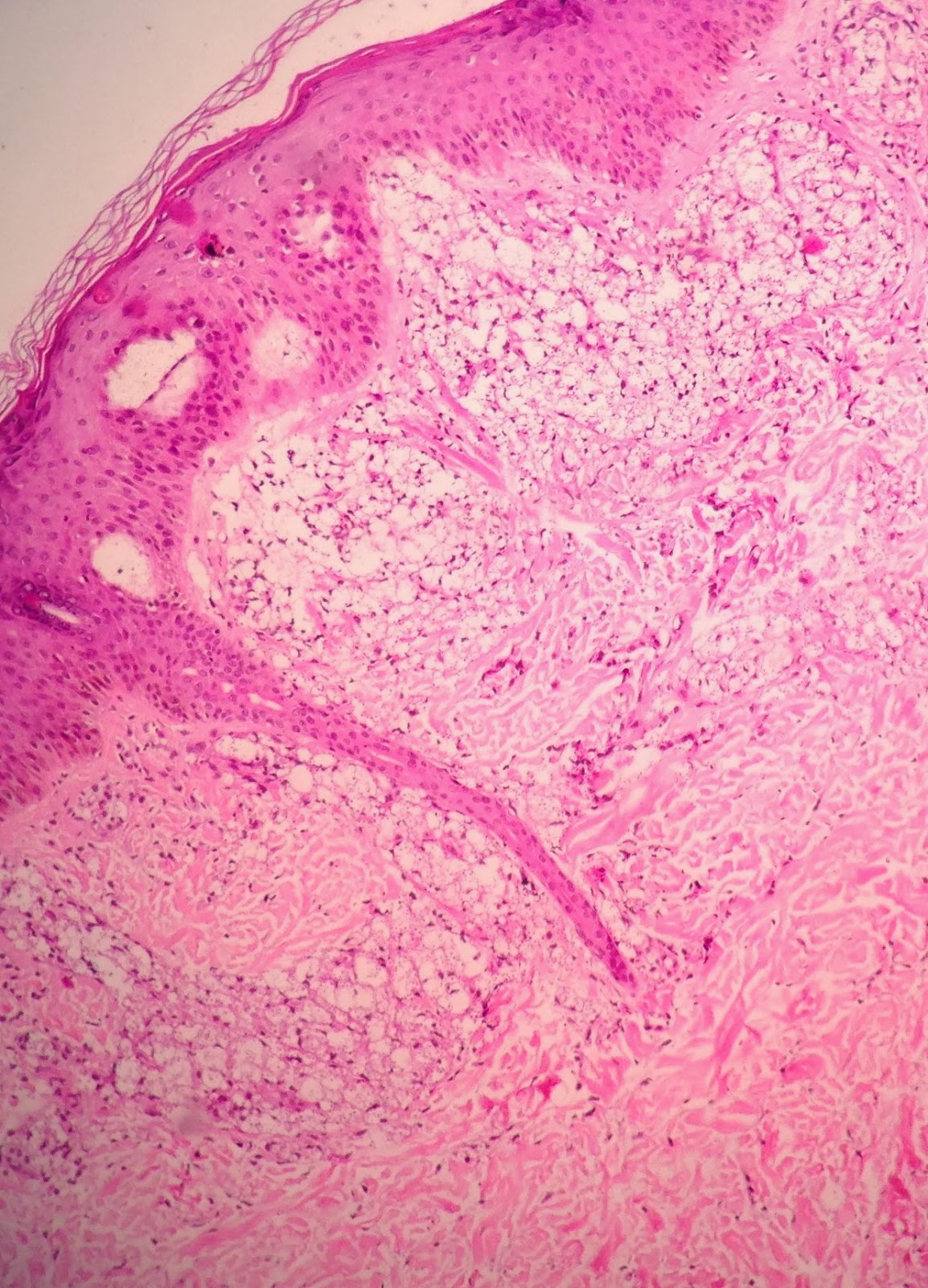 dermatopatologia para iniciantes: 2014