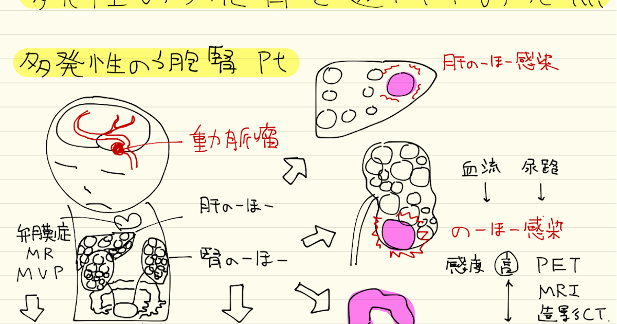 常染色体優性多発性嚢胞腎