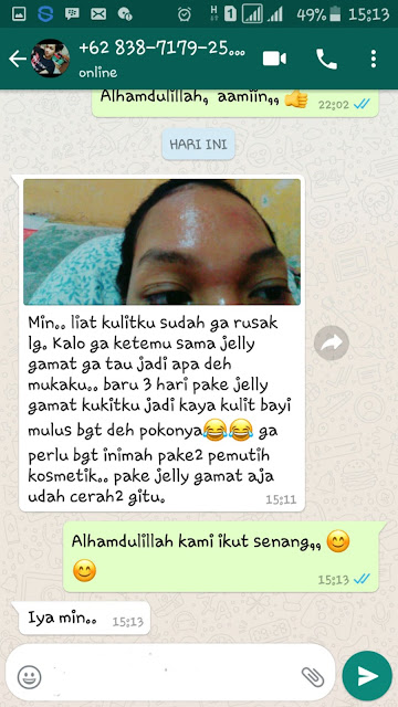 Cara Mengatasi Kulit Wajah Belang Dan Kering yang Terbukti Mujarab ~ TESTIMONI QNC JELLY GAMAT Cara Mengatasi Kulit Wajah Belang Dan Kering yang Terbukti Mujarab ~ TESTIMONI QNC JELLY GAMAT
