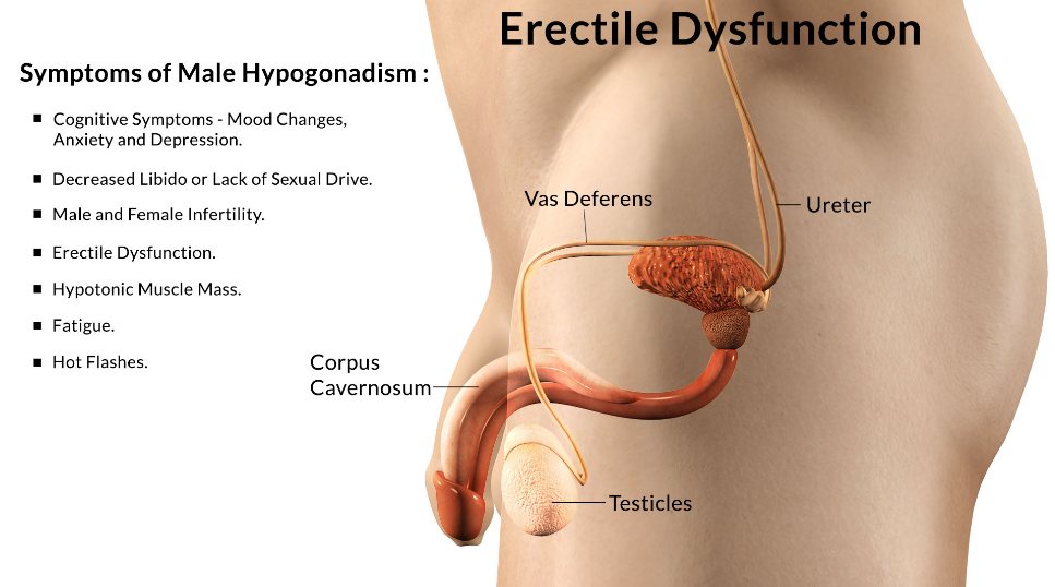 Disfunzione erettile: cause, sintomi e cura