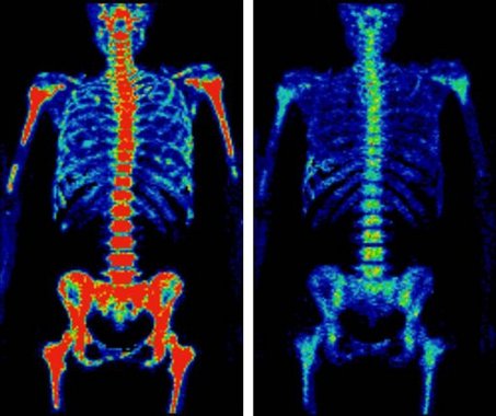 Ct scan iv trading system