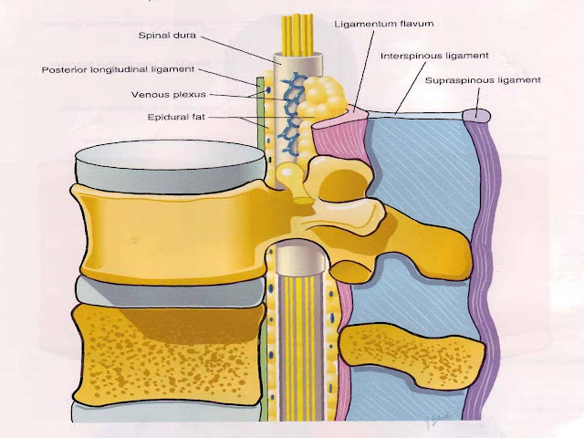 epidural space spinal lumbar anatomy puncture cord nerve spine steroid injections vertebrae pain canal intervertebral foramen health root pearls side