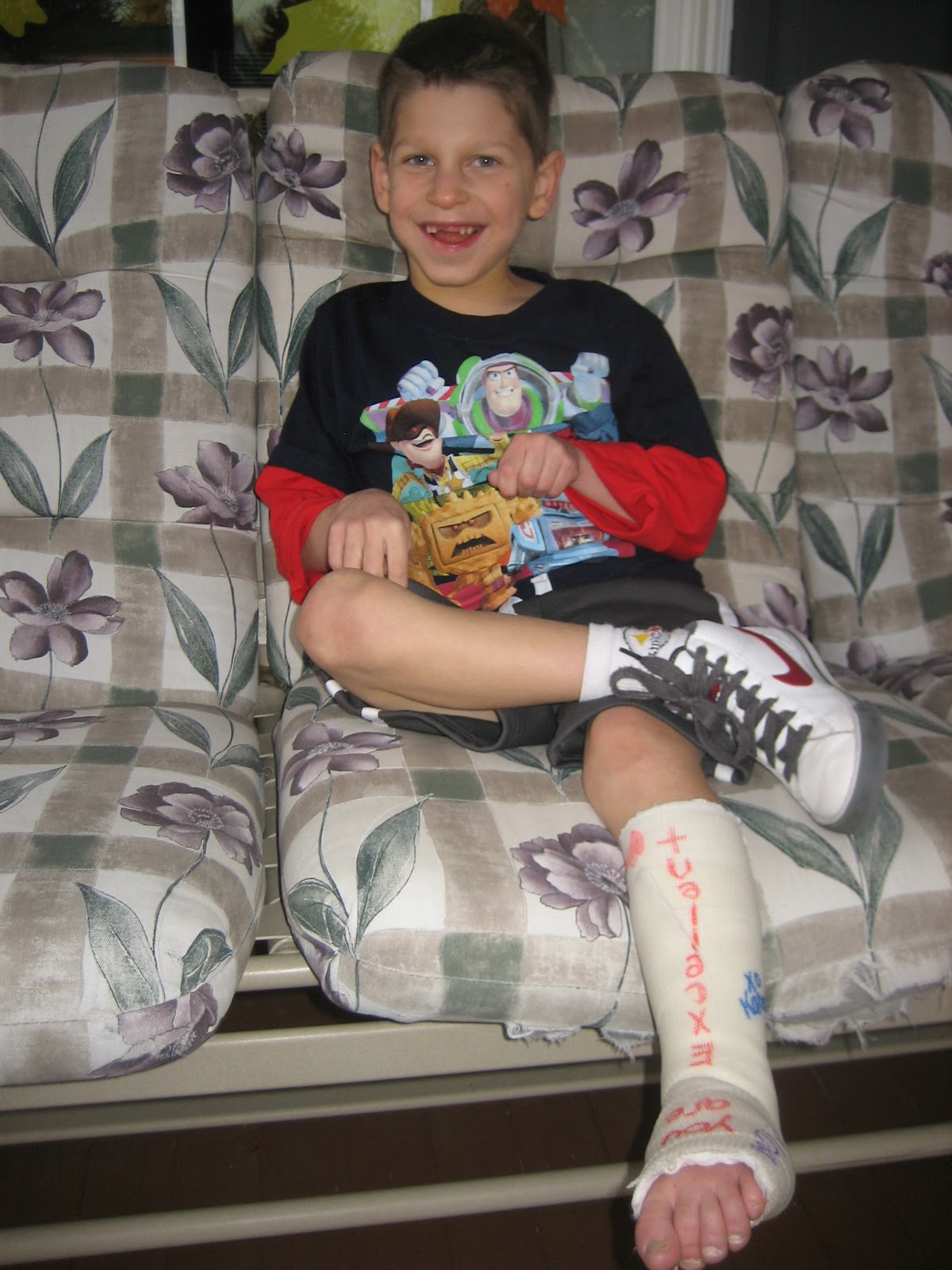 Kevin's Healing Journey Left Foot Cast 1