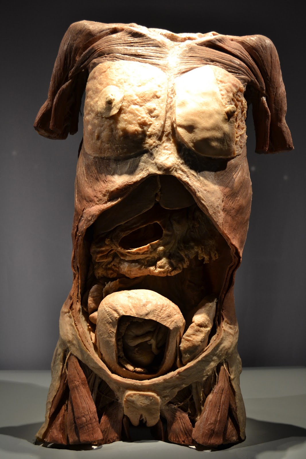 We'll Tell You - A&W Couple's Blog: The Human Bodies Exhibition at The
