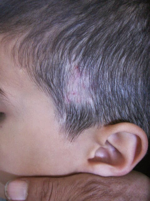 children with hair loss reviews
