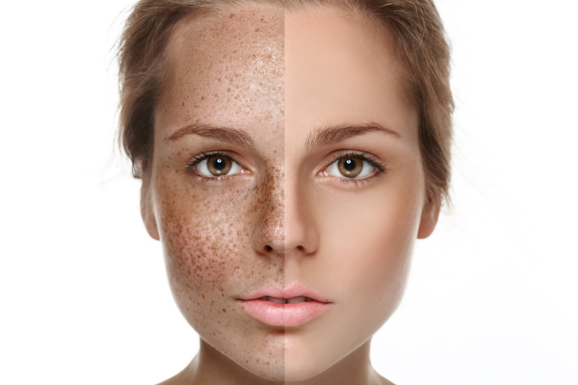 Nuala Woulfe Beauty Free Radicals