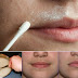 How to Remove Facial Hair Forever Within Minutes at Home