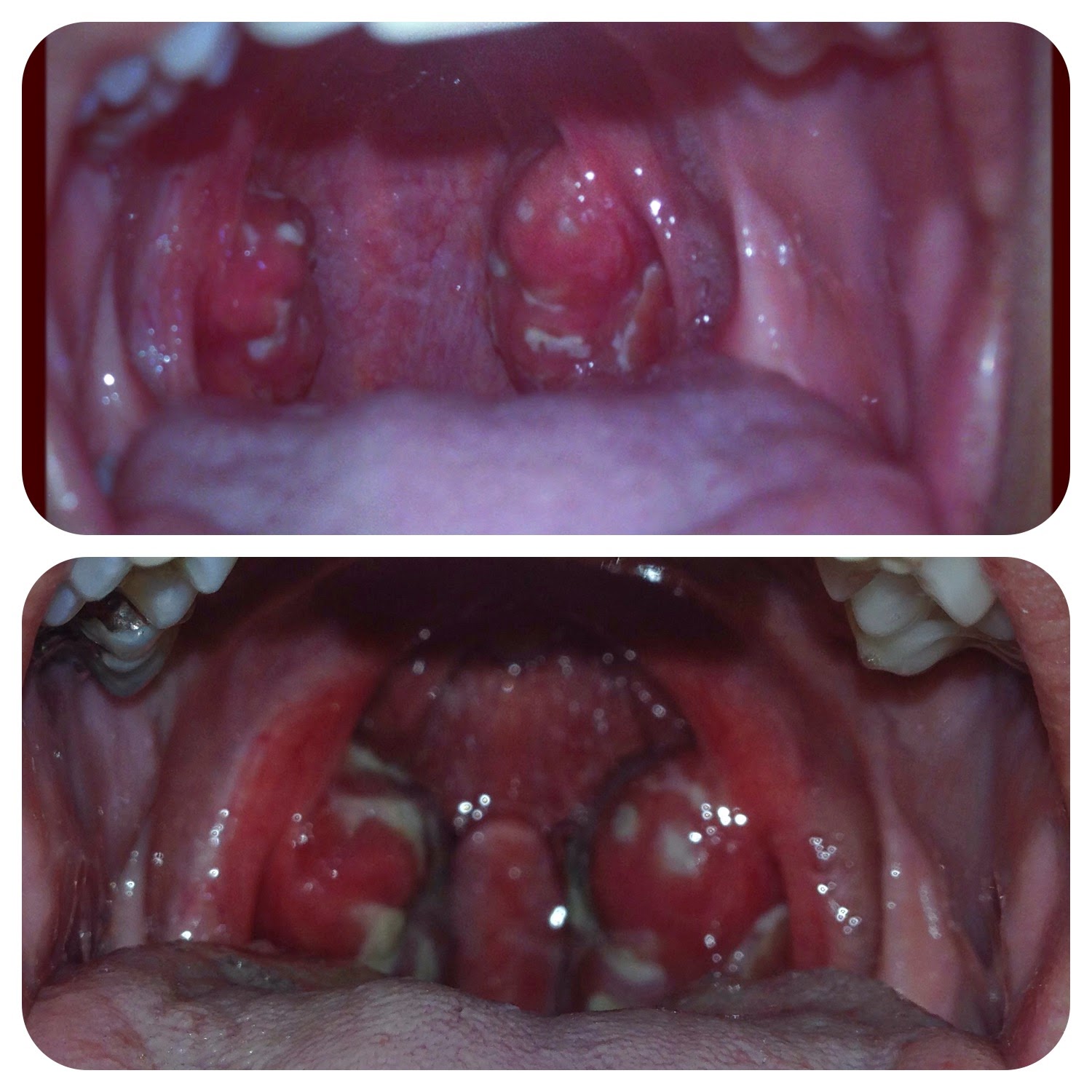 Deep throat painful