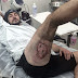iPhone 6 Explodes As Cyclist Falls Off and Suffers Third-Degree Burns