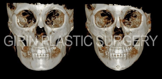 plastic surgery in korea essay plastic surgery in korea essay