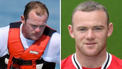 Unlike soccer gods David Beckham and Cristiano Ronaldo, Manchester United�s Wayne Rooney is not exactly worshiped for his looks. (Indeed, the movie star Wazza is most often compared to is Shrek.) But when the 25-year-old striker started losing his hair while very young, he decided to strike back. This summer, Rooney spent a reported �30,000 on a hair transplant and tweeted a TMI photo to his followers immediately afterward. �Hi all there's my head. It will take a few months to grow. Still a bit bloody too. But that's all normal. #hairwego.� But the new Roo �do is also helping his game�Rooney is off to a superb start in the English Premier League this season and, ironically, credits all his success to his barber.