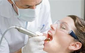 Trồng răng Implant được tiến hành như thế nào ?