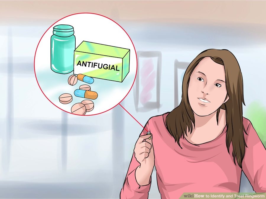 How to Identify and Treat Ringworm