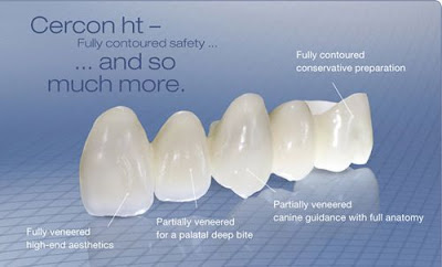 Thay đổi răng xấu nhờ công nghệ làm răng sứ mới