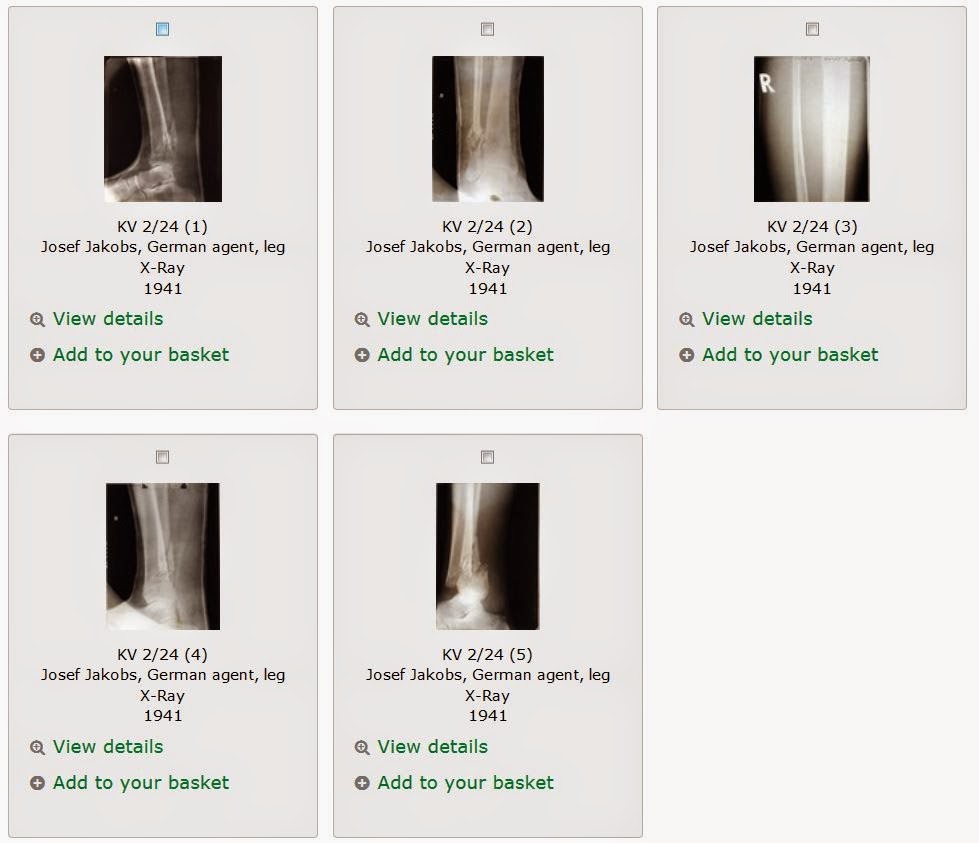 X-ray images of Josef Jakobs' right leg (from The National Archives) X-ray images of Josef Jakobs' right leg (from The National Archives)