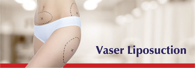 Liposuction in Mumbai Liposuction in Mumbai