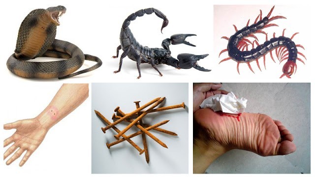 INFO KESEHATAN, Tolong Sebarkan!! Jika Kamu di GIGIT ULAR, LIPAN