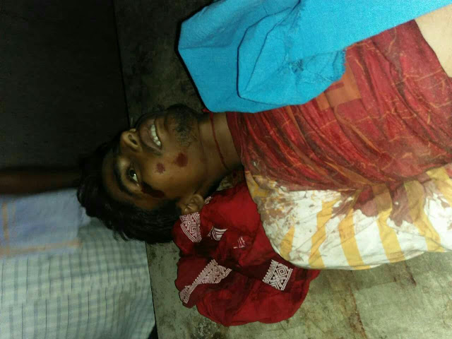बेतिया छावनी ढाला पर चाकू से गोदकर मैट्रिक छात्र की निर्ममतापूर्ण हत्या। तमाशबीन बने रहें लोग 1