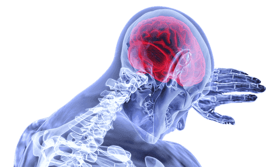 Brain Stroke, Types of, Symptoms, and Treatment. Brain Stroke, Types of, Symptoms, and Treatment.