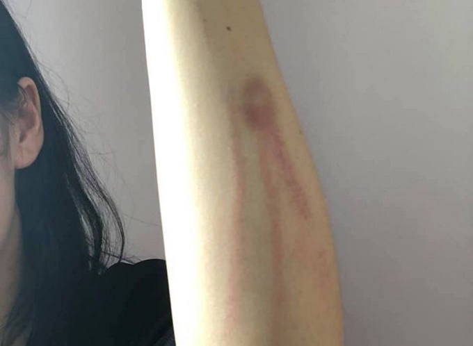 이미지에 대체텍스트 속성이 없습니다; 파일명은 htlk2zm89h1m2znnu827.jpg 입니다.