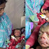 Shocking ! Baby Born Looking Like An 80-year-old Man (Photos)