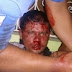 Ladrão é espancado por populares em povoado de Cícero Dantas-BA