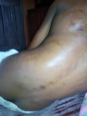 2 Photos: 11-year-old boy brutally assaulted and thrown out onto the streets by stepmother in Lagos