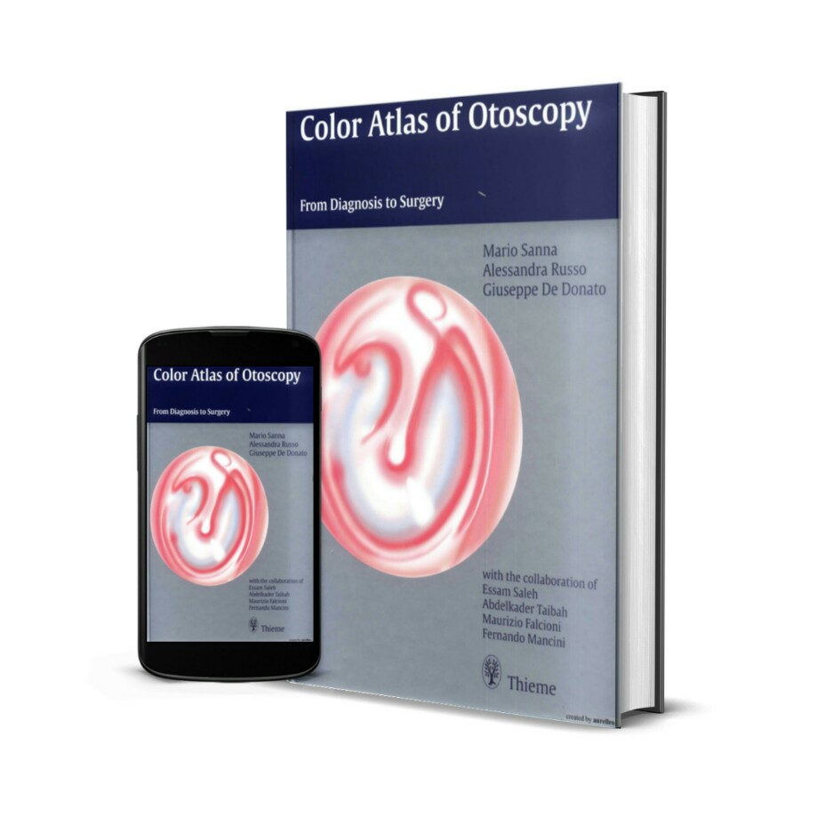 Color Atlas of Otoscopy From Diagnosis to Surgery PDF Gratuit