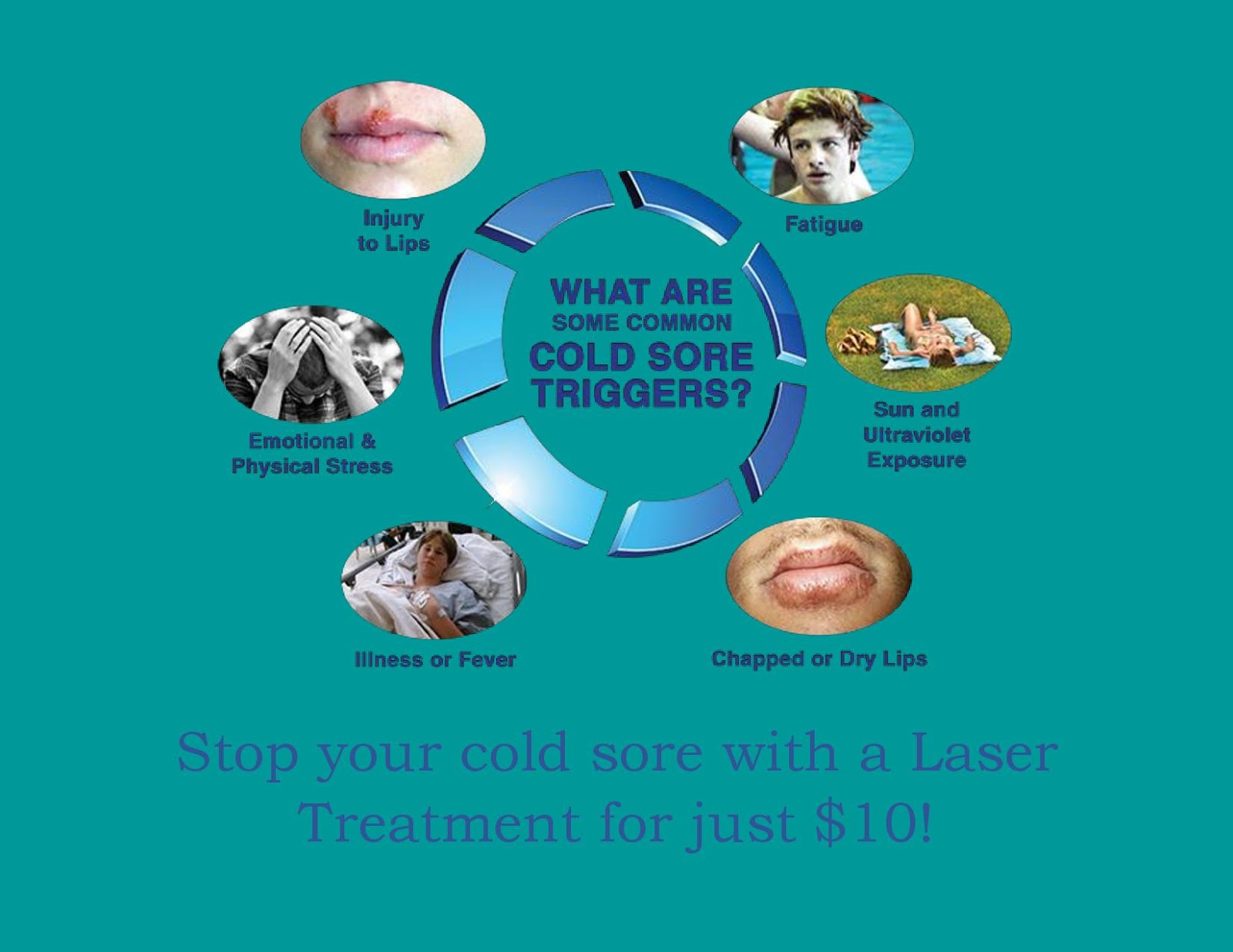 Introduction Stop Your Cold Sore with Laser Therapy!