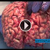 The Unfixed Brain - Amazing Video