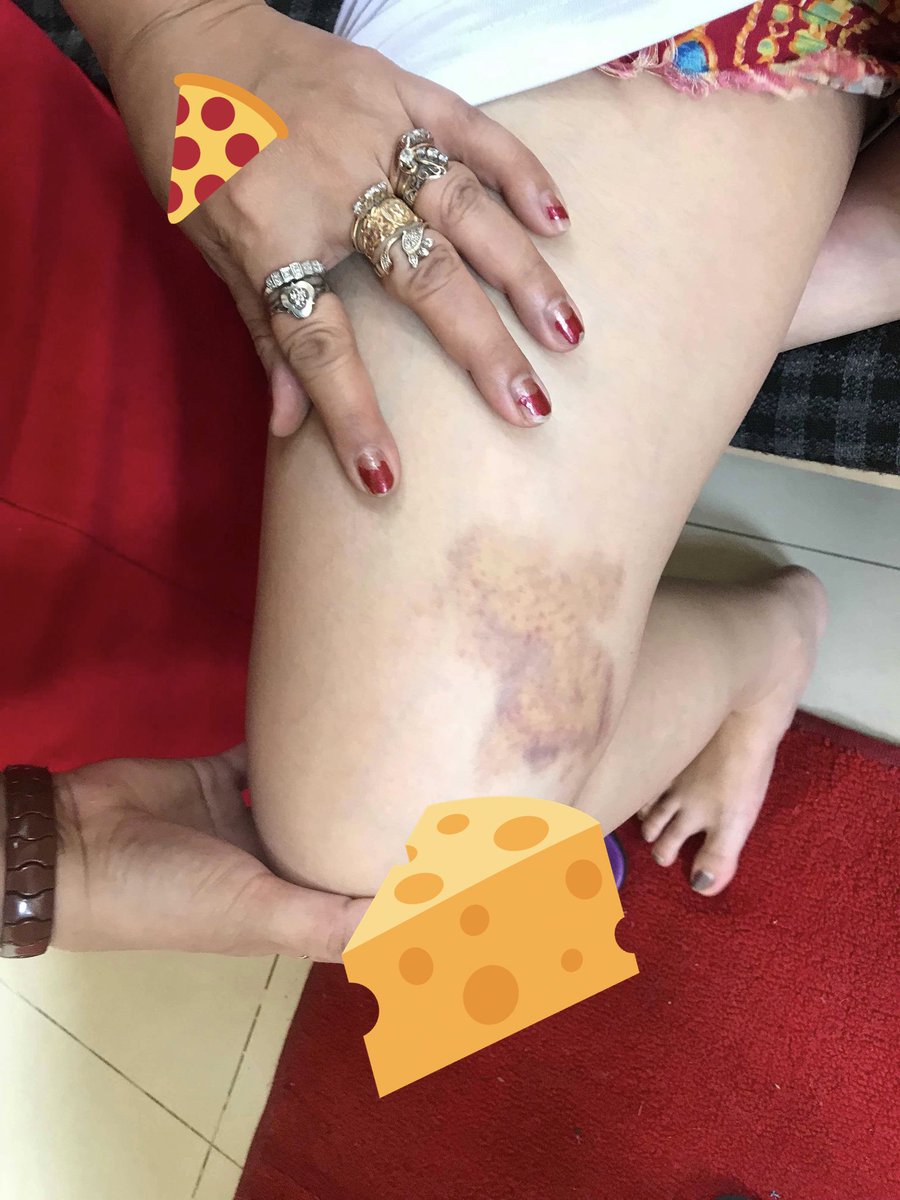 Guy only gets ‘community service’ for beating up GF, angers netizens Guy only gets ‘community service’ for beating up GF, angers netizens