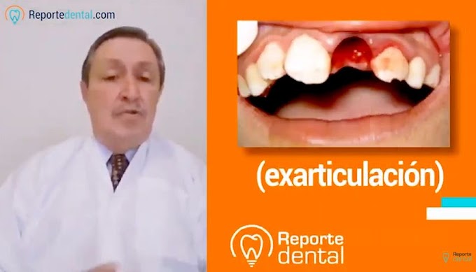 WEBINAR: Avulsión Dental - Dr. Darío Cárdenas Jaramillo