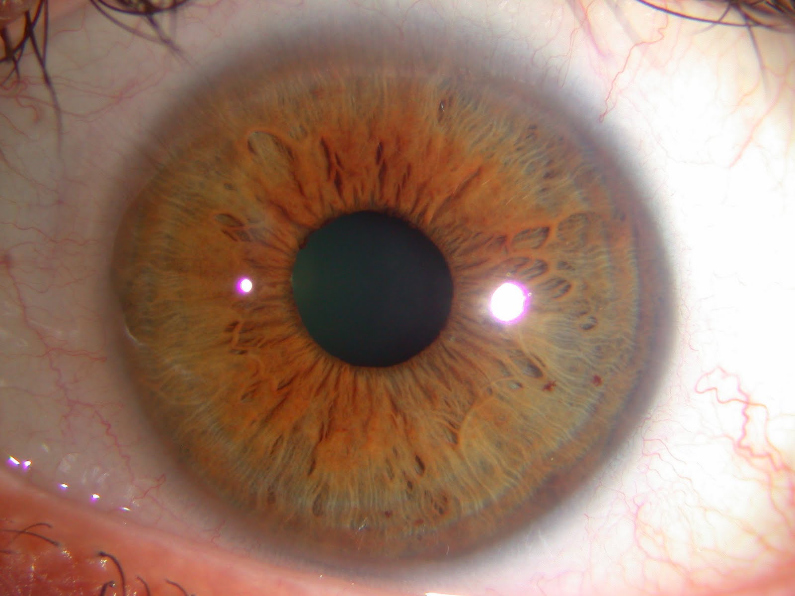 Modern & Multidimensional Iridology The Multidimensional Approach of