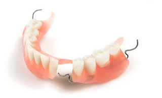 Răng giả nguyên hàm tháo lắp